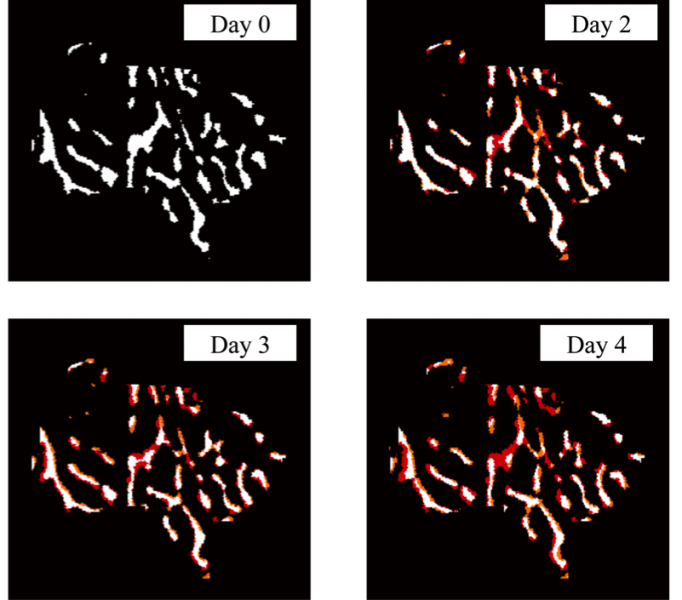 Trabecular Image Registration Bone loss initiation in the Trabecular Compartment of the Tibia