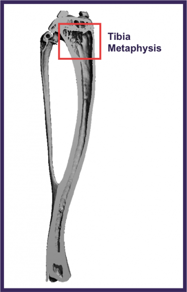 Tibia Metaphysis Scanning Location Tibia Metaphysis Scanning Location