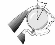 Reverse Total Shoulder Reverse Total Shoulder