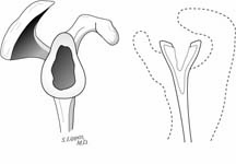 Reverse Total Shoulder Reverse Total Shoulder