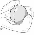 Reverse Total Shoulder Reverse Total Shoulder