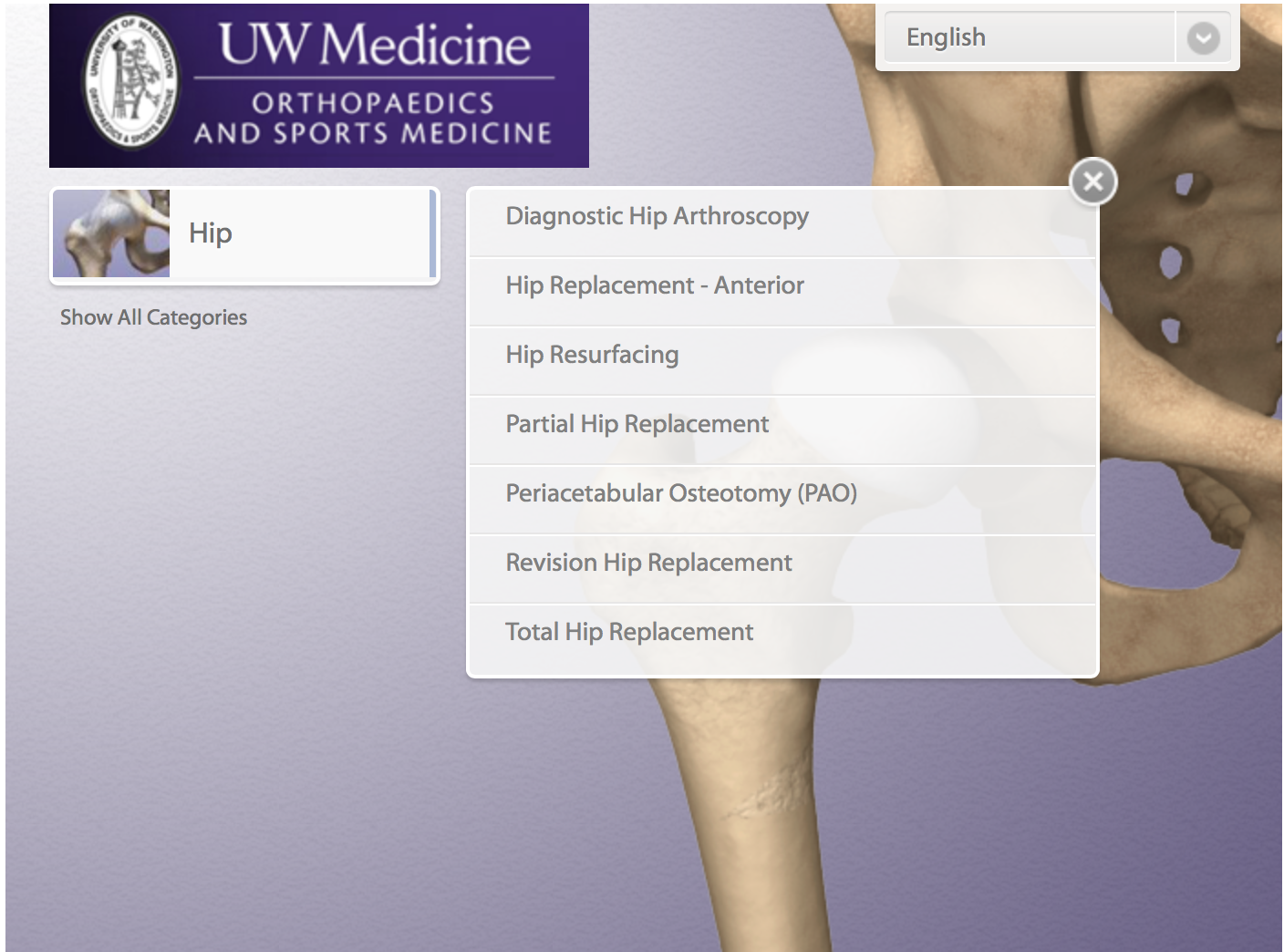 Hip and Knee Surgical Animations