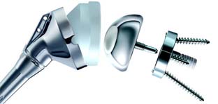 Reverse Total Shoulder