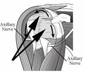 Reverse Total Shoulder